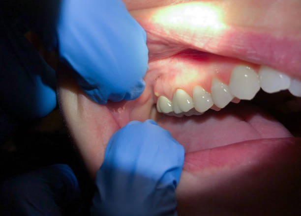 Best Pediatric Emergency Dentist in Elberton, GA